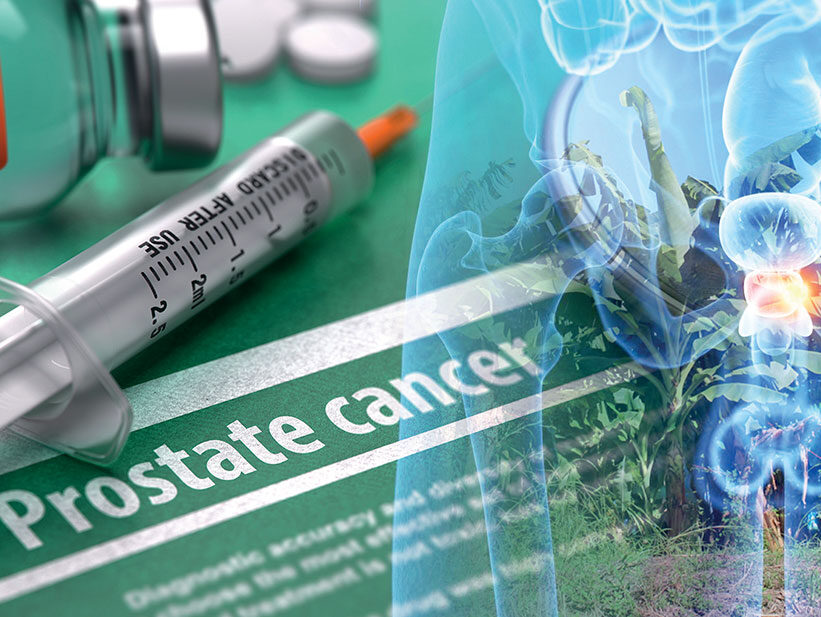 Chlordécone et cancer de la prostate : l’État lance enfin des recherches !